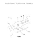 LOW PROFILE ELECTRODES FOR AN ANGIOPLASTY SHOCK WAVE CATHETER diagram and image