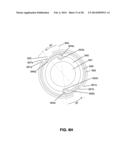 LOW PROFILE ELECTRODES FOR AN ANGIOPLASTY SHOCK WAVE CATHETER diagram and image