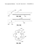 LOW PROFILE ELECTRODES FOR AN ANGIOPLASTY SHOCK WAVE CATHETER diagram and image