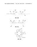 LOW PROFILE ELECTRODES FOR AN ANGIOPLASTY SHOCK WAVE CATHETER diagram and image