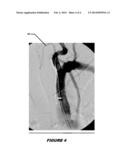 Precision External Control of Interventional Medical Procedures diagram and image