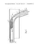 DOUBLE ENDED INTRAVASCULAR MEDICAL DEVICE diagram and image