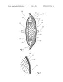 DEVICE FOR CLOSING OPENINGS OR CAVITIES IN BLOOD VESSELS diagram and image