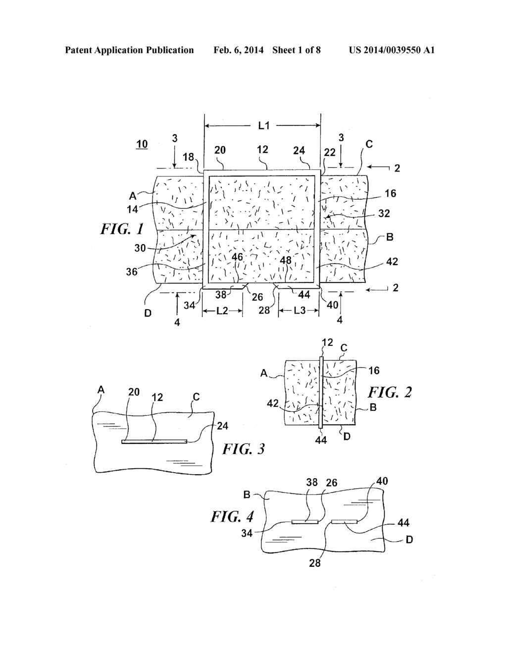 STAPLE FOR USE IN SURGICAL PROCEDURES - diagram, schematic, and image 02