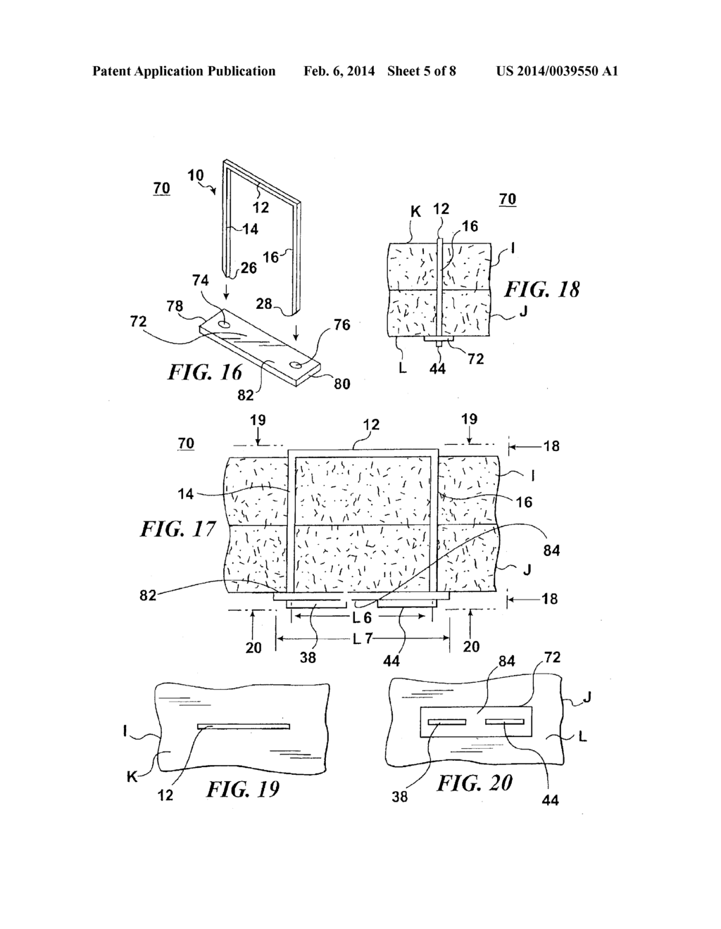 STAPLE FOR USE IN SURGICAL PROCEDURES - diagram, schematic, and image 06