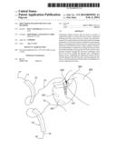 SOFT TISSUE FIXATION DEVICES AND METHODS diagram and image