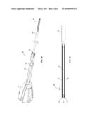 SOFT TISSUE FIXATION DEVICES AND METHODS diagram and image