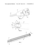 SOFT TISSUE FIXATION DEVICES AND METHODS diagram and image