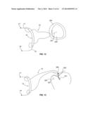 SOFT TISSUE FIXATION DEVICES AND METHODS diagram and image