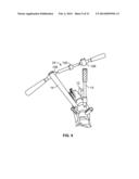 SPINE DEROTATION SYSTEM diagram and image