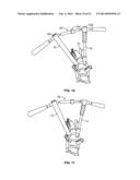 SPINE DEROTATION SYSTEM diagram and image