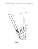 SPINE DEROTATION SYSTEM diagram and image