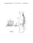 SYSTEM AND METHOD FOR POST-STROKE NEURAL REHABILITATION diagram and image