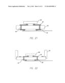 Package for an Implantable Neural Stimulation Device diagram and image