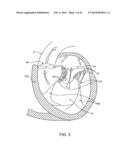 TRANSCATHETER MITRAL VALVE PROSTHESIS diagram and image