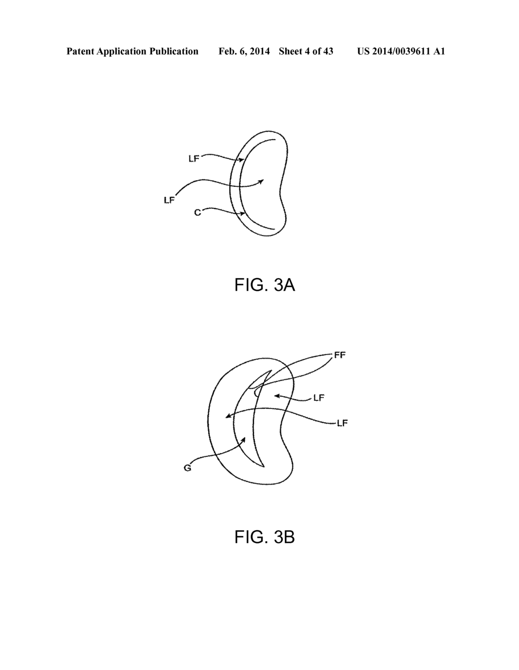 TRANSCATHETER MITRAL VALVE PROSTHESIS - diagram, schematic, and image 05