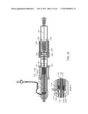 TRANSCATHETER MITRAL VALVE PROSTHESIS diagram and image