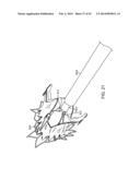 TRANSCATHETER MITRAL VALVE PROSTHESIS diagram and image