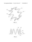 Method for Stabilizing a Cardiac Valve Annulus diagram and image