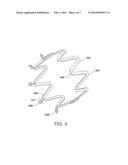 Method for Stabilizing a Cardiac Valve Annulus diagram and image