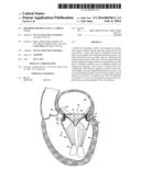 METHODS FOR REPLACING A CARDIAC VALVE diagram and image