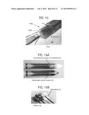 Stent-Valves For Valve Replacement and Associated Methods and Systems for     Surgery diagram and image