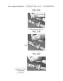 Stent-Valves For Valve Replacement and Associated Methods and Systems for     Surgery diagram and image