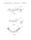 DEVICES AND METHODS FOR SURGICAL AND PERCUTANEOUS REPAIR OF HEART VALVE     LESIONS diagram and image