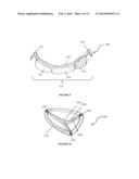 DEVICES AND METHODS FOR SURGICAL AND PERCUTANEOUS REPAIR OF HEART VALVE     LESIONS diagram and image