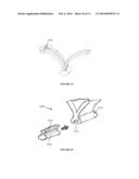 DEVICES AND METHODS FOR SURGICAL AND PERCUTANEOUS REPAIR OF HEART VALVE     LESIONS diagram and image