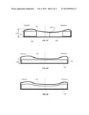 Connecting Mechanism for Medial and Lateral Polyethylene Bearing Surfaces     for Knee Replacement diagram and image