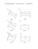 Connecting Mechanism for Medial and Lateral Polyethylene Bearing Surfaces     for Knee Replacement diagram and image