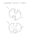 Connecting Mechanism for Medial and Lateral Polyethylene Bearing Surfaces     for Knee Replacement diagram and image