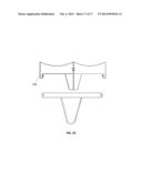 Connecting Mechanism for Medial and Lateral Polyethylene Bearing Surfaces     for Knee Replacement diagram and image