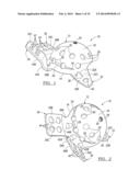 Method And Apparatus For Acetabular Reconstruction diagram and image