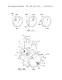 Method And Apparatus For Acetabular Reconstruction diagram and image