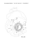 Method And Apparatus For Acetabular Reconstruction diagram and image