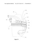 MODULAR PROSTHETIC DEVICES AND PROSTHESIS SYSTEM diagram and image