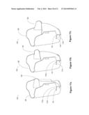 MODULAR PROSTHETIC DEVICES AND PROSTHESIS SYSTEM diagram and image