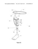 MODULAR PROSTHETIC DEVICES AND PROSTHESIS SYSTEM diagram and image