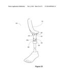 MODULAR PROSTHETIC DEVICES AND PROSTHESIS SYSTEM diagram and image