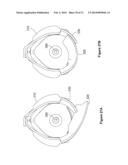 MODULAR PROSTHETIC DEVICES AND PROSTHESIS SYSTEM diagram and image