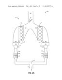 NOX CONTROL DURING CYLINDER DEACTIVATION diagram and image