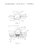 HEALING ABUTMENT AND METHOD FOR PRODUCING A DESIGN OF A HEALING ABUTMENT diagram and image