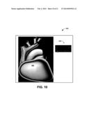 GRAPHICAL TOOL FOR MANAGING A LONGITUDINAL PATIENT EPISODE diagram and image