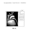 GRAPHICAL TOOL FOR MANAGING A LONGITUDINAL PATIENT EPISODE diagram and image