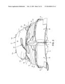 INFLATABLE SLING AND METHOD FOR POSITIONING A PATIENT diagram and image