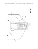 WINDOW REGULATOR ASSEMBLY FOR A VEHICLE diagram and image