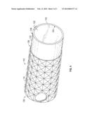 TUBULAR DEVICE AND ACTUATOR diagram and image