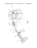 ARCHERY BOW LIMB DAMPENING SYSTEM diagram and image